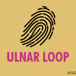 Ulnar Loop