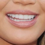 lips-that-are-naturally-plumper-in-the-center-of-the-upper-and-lower-lip