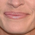 lips-with-an-undefined-cupids-bow
