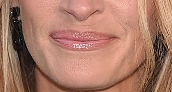 lips-with-an-undefined-cupids-bow