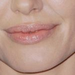 naturally-full-top-and-bottom-lips