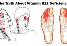 Truth About Vitamin B12 Deficiency